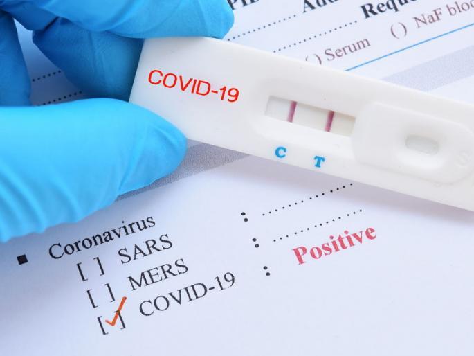 Coronavirus In Aurangabad : Antigen test to be conducted in the city now; Attention to 50,000 tests | Coronavirus In Aurangabad : शहरात आता होणार अँटीजन पद्धतीने टेस्ट; ५० हजार टेस्टचे लक्ष Coronavirus In Aurangabad : Antigen test to be conducted in the city now; Attention to 50,000 tests | Coronavirus In Aurangabad : शहरात आता होणार अँटीजन पद्धतीने टेस्ट; ५० हजार टेस्टचे लक्ष