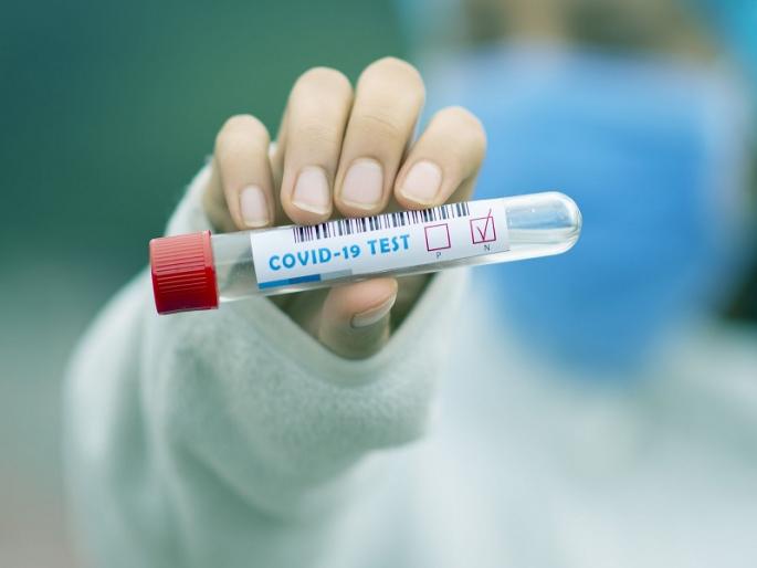 Corona testing scam worth lakhs in Pune; Attempts by senior officials to suppress the scam | पुण्यात लाखाेंचा काेराेना टेस्टिंग घाेटाळा; बड्या अधिकाऱ्यांकडून घाेटाळा दाबण्याचा प्रयत्न Corona testing scam worth lakhs in Pune; Attempts by senior officials to suppress the scam | पुण्यात लाखाेंचा काेराेना टेस्टिंग घाेटाळा; बड्या अधिकाऱ्यांकडून घाेटाळा दाबण्याचा प्रयत्न