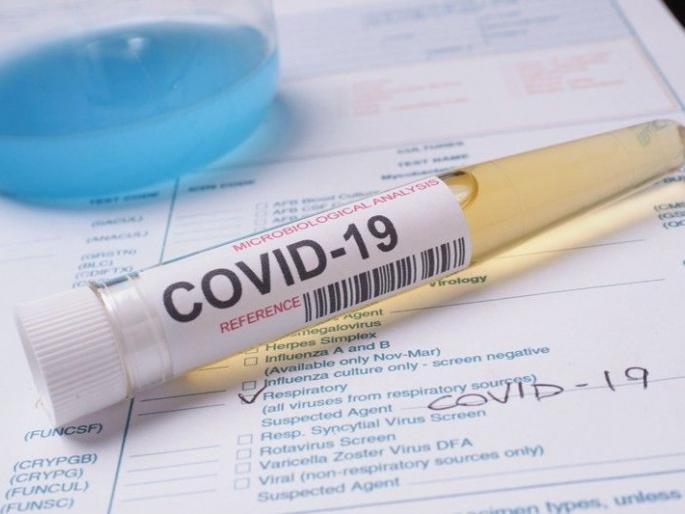 Four more corona positive in Washim district; Number of patients 122 | वाशिम जिल्ह्यात आणखी चार कोरोना पॉझिटिव्ह; रुग्णसंख्या १२२ Four more corona positive in Washim district; Number of patients 122 | वाशिम जिल्ह्यात आणखी चार कोरोना पॉझिटिव्ह; रुग्णसंख्या १२२