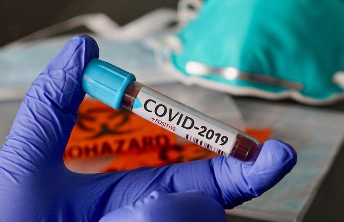 Coronavirus: crossed 12,000 patients in Aurangabad district | Coronavirus : औरंगाबाद जिल्ह्यात रुग्णसंख्या १२ हजार पार Coronavirus: crossed 12,000 patients in Aurangabad district | Coronavirus : औरंगाबाद जिल्ह्यात रुग्णसंख्या १२ हजार पार