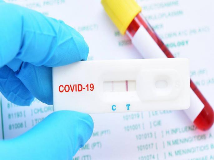 Corona Virus : 1,240 recovered on Tuesday in Pune ; Addition of 924 new patients | Corona Virus : पुणे शहरात मंगळवारी १ हजार २४० जण कोरोनामुक्त ; ९२४ नव्या रुग्णांची वाढ Corona Virus : 1,240 recovered on Tuesday in Pune ; Addition of 924 new patients | Corona Virus : पुणे शहरात मंगळवारी १ हजार २४० जण कोरोनामुक्त ; ९२४ नव्या रुग्णांची वाढ