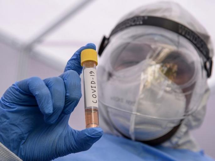 CoronaVirus in Akola: two more victims; 78 new positive, death toll 76 | CoronaVirus in Akola : आणखी दोन बळी; ७८ नवे पॉझिटिव्ह, मृतांचा आकडा ७६ CoronaVirus in Akola: two more victims; 78 new positive, death toll 76 | CoronaVirus in Akola : आणखी दोन बळी; ७८ नवे पॉझिटिव्ह, मृतांचा आकडा ७६