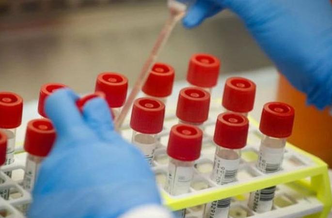Coronavirus In Aurangabad: The number of coronavirus patients in Aurangabad district is on the threshold of 13,000 | Coronavirus In Aurangabad : औरंगाबाद जिल्ह्यात कोरोनाबाधितांची संख्या १३ हजारांच्या उंबरठ्यावर