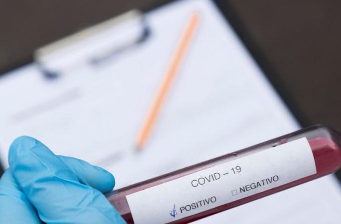 Corona test of 6,000 teachers in Buldana district, 18 positive | बुलडाणा जिल्ह्यात सहा हजार शिक्षकांची कोरोना चाचणी, १८ पॉझिटिव्ह Corona test of 6,000 teachers in Buldana district, 18 positive | बुलडाणा जिल्ह्यात सहा हजार शिक्षकांची कोरोना चाचणी, १८ पॉझिटिव्ह