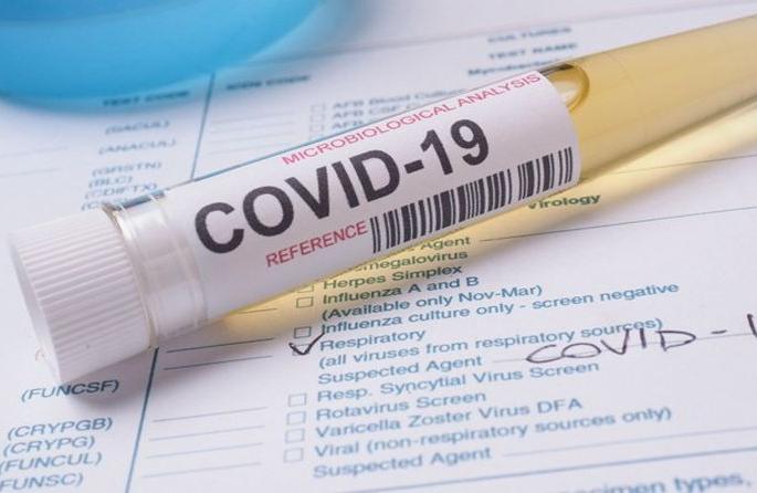 Coronavirus in Akola: 65 more positive patients! | Coronavirus in Akola : आणखी ६५ पॉझिटिव्ह रुग्ण! Coronavirus in Akola: 65 more positive patients! | Coronavirus in Akola : आणखी ६५ पॉझिटिव्ह रुग्ण!