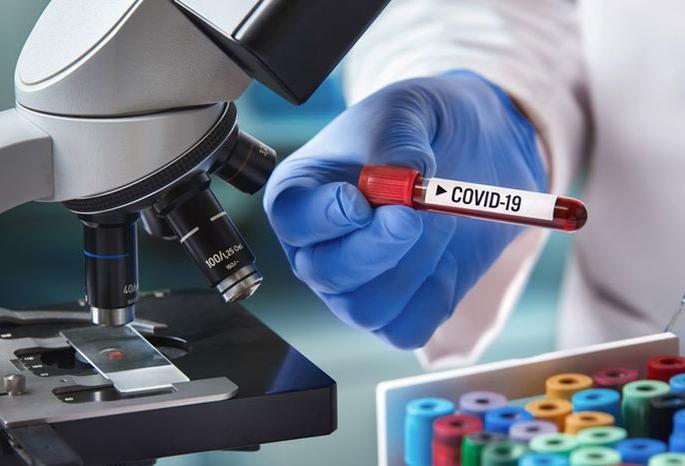 CoronaVirus: one death in a day; 30 positive, total number of patients at 1136 | CoronaVirus : दिवसभरात एकाचा मृत्यू ; ३० पॉझिटिव्ह, एकूण रुग्णसंख्या ११३६ वर CoronaVirus: one death in a day; 30 positive, total number of patients at 1136 | CoronaVirus : दिवसभरात एकाचा मृत्यू ; ३० पॉझिटिव्ह, एकूण रुग्णसंख्या ११३६ वर