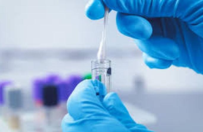 CoronaVirus: 13 more positive patients found in Akola district | CoronaVirus : अकोला जिल्ह्यात आणखी १३ पॉझिटिव्ह रुग्ण आढळले