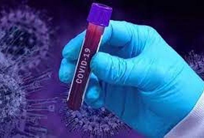CoronaVirus: 50 positive in Washim district; Number of patients 488 | CoronaVirus : वाशिम जिल्ह्यात ५० पॉझिटिव्ह; रुग्णसंख्या ४८८ CoronaVirus: 50 positive in Washim district; Number of patients 488 | CoronaVirus : वाशिम जिल्ह्यात ५० पॉझिटिव्ह; रुग्णसंख्या ४८८