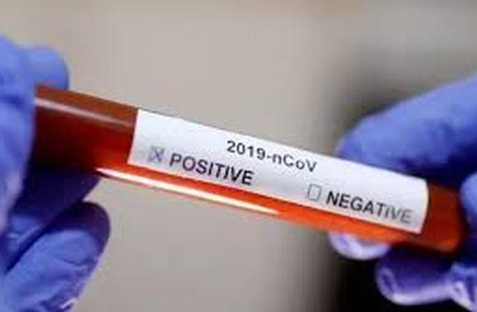 CoronaVirus: 40 person in Patur reported negative results | CoronaVirus : पातुरातील ४० जणांचा अहवाल निगेटिव्ह आल्याने दिलासा CoronaVirus: 40 person in Patur reported negative results | CoronaVirus : पातुरातील ४० जणांचा अहवाल निगेटिव्ह आल्याने दिलासा