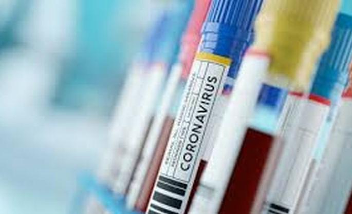 The number of covid positive reports decreased; As soon as the graph of death rises! | कोविड पॉझिटिव्ह अहवालांची संख्या घटली; मृत्यूचा आलेख मात्र चढताच!