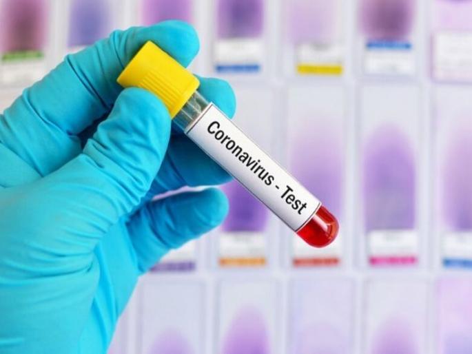 It's time to say Ram ... but! | CoronaVirus in Akola : हे राम म्हणायची वेळ आलीच...पण! It's time to say Ram ... but! | CoronaVirus in Akola : हे राम म्हणायची वेळ आलीच...पण!