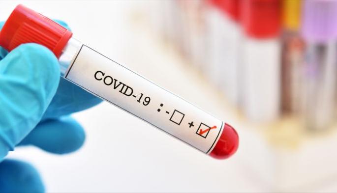 Another 25 positive corona patients were found in Akola district | अकोला जिल्ह्यात कोरोनाचे आणखी २५ पॉझिटिव्ह रुग्ण आढळले Another 25 positive corona patients were found in Akola district | अकोला जिल्ह्यात कोरोनाचे आणखी २५ पॉझिटिव्ह रुग्ण आढळले