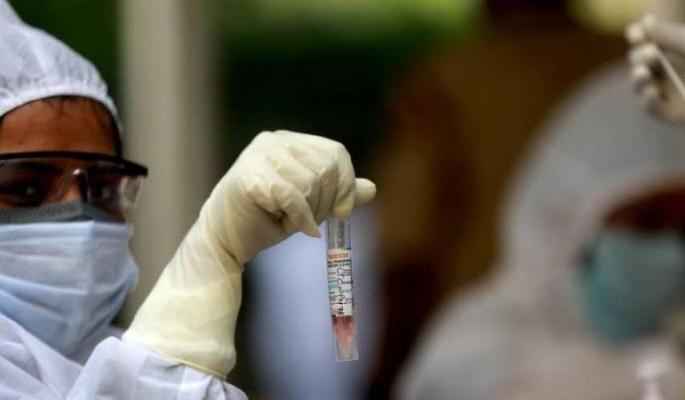 CoronaVirus in Akola: Death of another; 33 new positives, 50 corona free | CoronaVirus in Akola : आणखी एकाचा मृत्यू; ३३ नवे पॉझिटिव्ह, ५० कोरोनामुक्त CoronaVirus in Akola: Death of another; 33 new positives, 50 corona free | CoronaVirus in Akola : आणखी एकाचा मृत्यू; ३३ नवे पॉझिटिव्ह, ५० कोरोनामुक्त