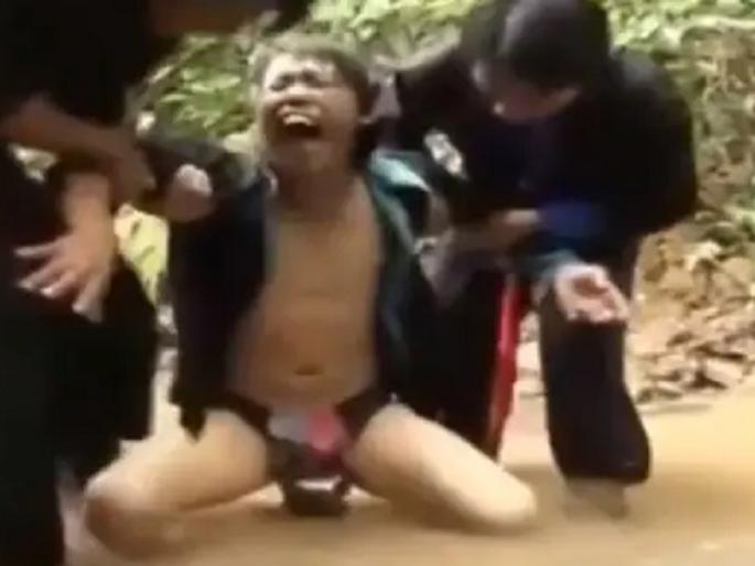 crab stuck to underwear after man went to catch fish in pond wearing shorts  | Oh no! तरुणाला मासे पकडणं भलतंच भारी पडलं, खेकड्याने पकडला प्रायव्हेट पार्ट!  crab stuck to underwear after man went to catch fish in pond wearing shorts  | Oh no! तरुणाला मासे पकडणं भलतंच भारी पडलं, खेकड्याने पकडला प्रायव्हेट पार्ट!