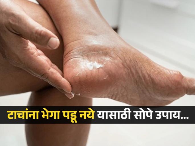 Easy and Beneficial Cracked Heels Care Tips in Winter | 'या' थंडीत टाचांवरील भेगा देणार नाही त्रास, फक्त रोज करावे लागतील 'हे' उपाय!