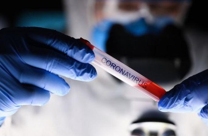 Corona Virus in Akola: Four die, 48 new positive, 33 corona free | CoronaVirus in Akola : चौघांचा मृत्यू, ४८ नवे पॉझिटिव्ह, ३३ जण कोरोनामुक्त