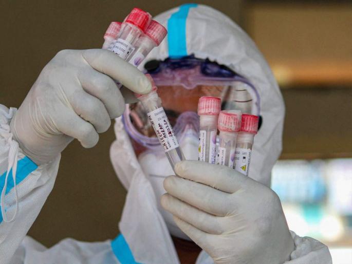 Corona Cases in Akola: Death of another; 151 Positive | Corona Cases in Akola : आणखी एकाचा मृत्यू; १५१ पॉझिटिव्ह Corona Cases in Akola: Death of another; 151 Positive | Corona Cases in Akola : आणखी एकाचा मृत्यू; १५१ पॉझिटिव्ह