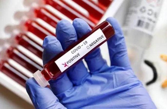 Corona Cases in Buldhana: None positive in 9 talukas; 13 new positives | Corona Cases in Buldhana : ९ तालुक्यात एकही पाॅझिटीव्ह नाही; १३ नवे पाॅझिटीव्ह Corona Cases in Buldhana: None positive in 9 talukas; 13 new positives | Corona Cases in Buldhana : ९ तालुक्यात एकही पाॅझिटीव्ह नाही; १३ नवे पाॅझिटीव्ह
