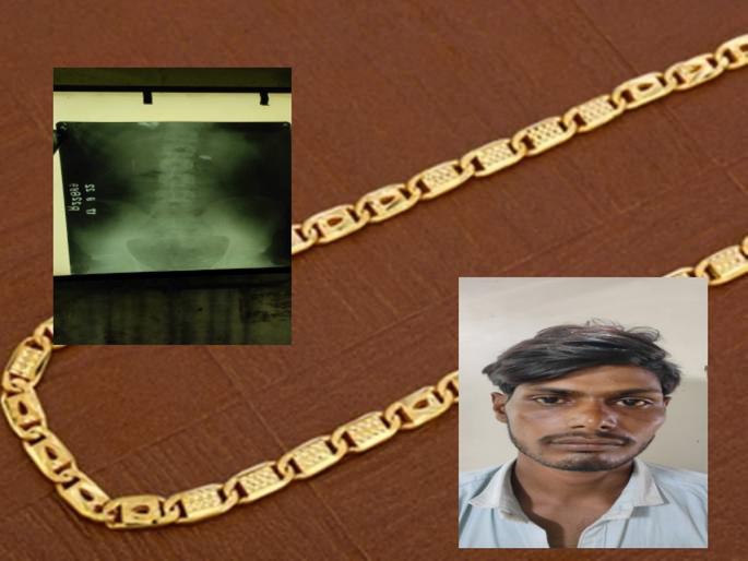 The thief swallowed the gold chain, took it to the hospital and brought it out | चोराने गिळली सोनसाखळी, दवाख्यान्यात नेऊन बाहेर काढली The thief swallowed the gold chain, took it to the hospital and brought it out | चोराने गिळली सोनसाखळी, दवाख्यान्यात नेऊन बाहेर काढली