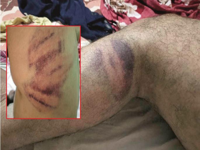 Delay in parcel delivery, delivery boy brutally beaten by police with baton in Chhatrapati Sambhajinagar | पार्सल देण्यास उशीर, डिलीव्हरी बॉयला पोलिसाची लाठीने अमानुष मारहाण Delay in parcel delivery, delivery boy brutally beaten by police with baton in Chhatrapati Sambhajinagar | पार्सल देण्यास उशीर, डिलीव्हरी बॉयला पोलिसाची लाठीने अमानुष मारहाण
