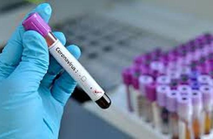 Seven deaths in a day; 87 new positive, 185 coronal free | दिवसभरात सात जणांचा मृत्यू; ८७ नवे पॉझिटिव्ह, १८५ कोरोनामुक्त Seven deaths in a day; 87 new positive, 185 coronal free | दिवसभरात सात जणांचा मृत्यू; ८७ नवे पॉझिटिव्ह, १८५ कोरोनामुक्त