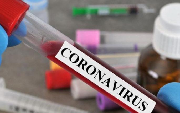 CoronaVirus in Akola: 21 patients increased in a day; 81 people recovered! | CoronaVirus in Akola : दिवसभरात २१ रुग्ण वाढले; ८१ जण बरे झाले! CoronaVirus in Akola: 21 patients increased in a day; 81 people recovered! | CoronaVirus in Akola : दिवसभरात २१ रुग्ण वाढले; ८१ जण बरे झाले!