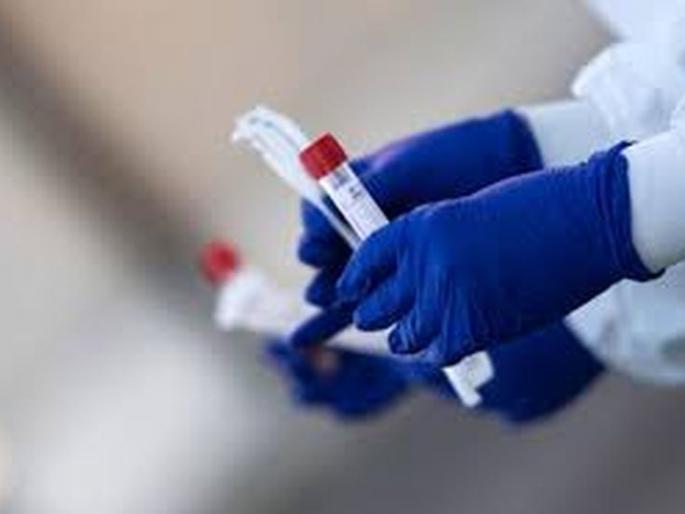 CoronaVirus in Akola: 20 corona free in a day; 22 patients increased | CoronaVirus in Akola : दिवसभरात २० कोरोनामुक्त झाले; २२ रुग्ण वाढले