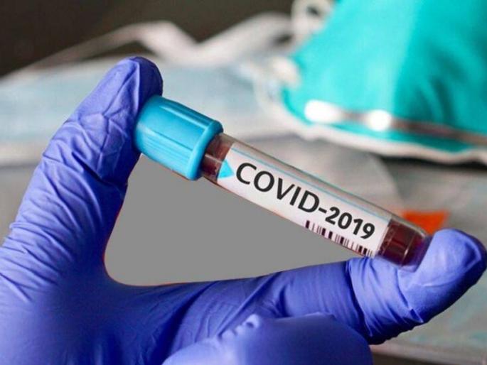 Coronavirus Akola updates: Another 393 corona positive in Akola | Coronavirus Akola updates : अकोल्यात आणखी ३९३ कोरोना पॉझिटिव्ह Coronavirus Akola updates: Another 393 corona positive in Akola | Coronavirus Akola updates : अकोल्यात आणखी ३९३ कोरोना पॉझिटिव्ह