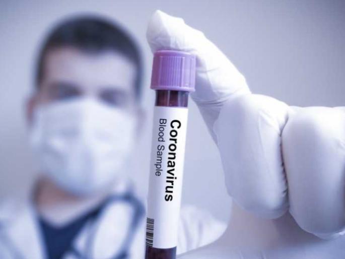 4403 patients in Thane district; 110 new patients were found in one day MMG | ठाणे जिल्ह्यातील रुग्ण संख्या 4403; एक दिवसात आढळले ११० नवे रुग्ण 4403 patients in Thane district; 110 new patients were found in one day MMG | ठाणे जिल्ह्यातील रुग्ण संख्या 4403; एक दिवसात आढळले ११० नवे रुग्ण