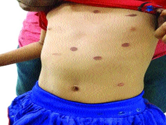 Navi Mumbai Child News | मस्ती करते म्हणून चिमुरडीला मेणबत्तीने चटके Navi Mumbai Child News | मस्ती करते म्हणून चिमुरडीला मेणबत्तीने चटके