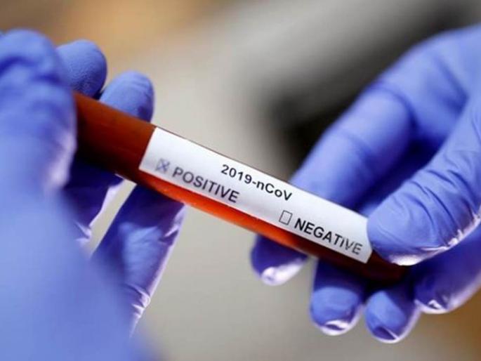 CoronaVirus: 17 more positive in Buldana district; Number of patients 230 | CoronaVirus : बुलडाणा जिल्ह्यात आणखी १७ पॉझीटीव्ह; रुग्णसंख्या २३० CoronaVirus: 17 more positive in Buldana district; Number of patients 230 | CoronaVirus : बुलडाणा जिल्ह्यात आणखी १७ पॉझीटीव्ह; रुग्णसंख्या २३०