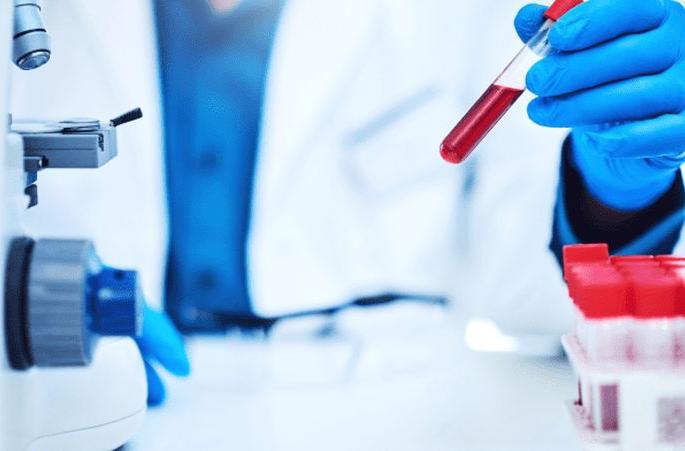 CoronaVirus: A doctor positive in Jalgaon | CoronaVirus : जळगावात एक डॉक्टर पॉझिटिव्ह CoronaVirus: A doctor positive in Jalgaon | CoronaVirus : जळगावात एक डॉक्टर पॉझिटिव्ह
