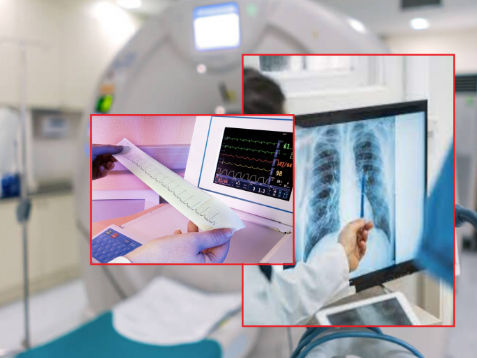 CTscan, ECG, X-ray of youth free; Have you had a health check up? | तरुणांचे सीटीस्कॅन, ईसीजी, एक्स-रे मोफत; आरोग्य तपासणी केली का?