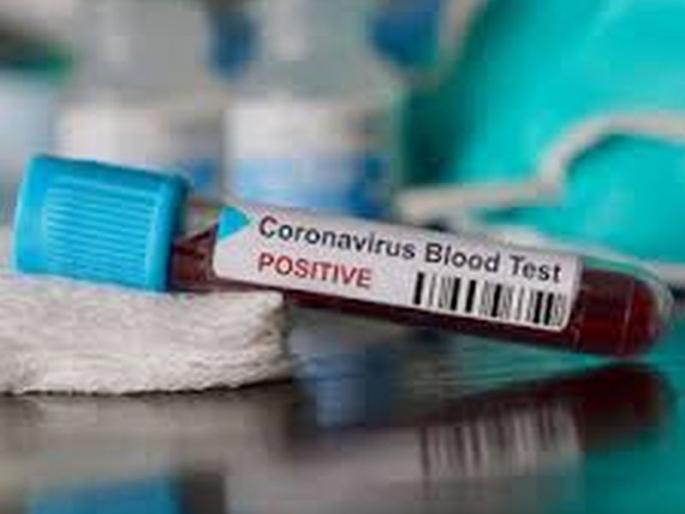 Cornavirus In Akola Contact with the patient after treatment; Say you are positive! | उपचार घेतल्यावर रुग्णाशी संपर्क; म्हणे तुम्ही पॉझिटिव्ह! Cornavirus In Akola Contact with the patient after treatment; Say you are positive! | उपचार घेतल्यावर रुग्णाशी संपर्क; म्हणे तुम्ही पॉझिटिव्ह!