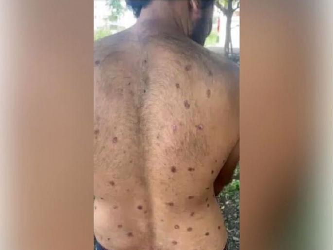 Betel nut trader missing for five months found, claims to be kidnapped | पाच महिन्यांपासून गायब सुपारी व्यापारी सापडला, अपहरण झाल्याचा दावा Betel nut trader missing for five months found, claims to be kidnapped | पाच महिन्यांपासून गायब सुपारी व्यापारी सापडला, अपहरण झाल्याचा दावा