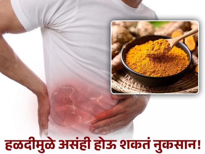 Do not make this mistake while consuming turmeric, the risk of kidney damage may increase! | हळदीचं सेवन करताना करू नका 'ही' चूक, किडनी डॅमेजचा वाढू शकतो धोका! Do not make this mistake while consuming turmeric, the risk of kidney damage may increase! | हळदीचं सेवन करताना करू नका 'ही' चूक, किडनी डॅमेजचा वाढू शकतो धोका!