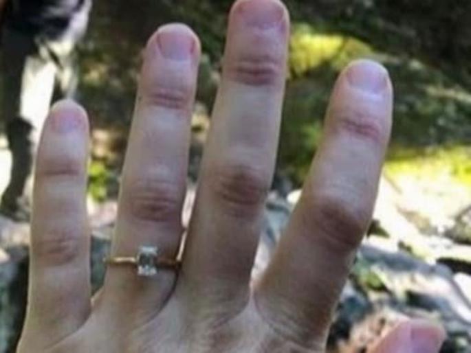 Bride to be flaunted diamond engagement ring but people spotted her boyfriend peeing | लोकांना हिऱ्याची अंगठी दाखवत होती महिला, फोटोत कैद झाला लघुशंका करणारा बॉयफ्रेन्ड Bride to be flaunted diamond engagement ring but people spotted her boyfriend peeing | लोकांना हिऱ्याची अंगठी दाखवत होती महिला, फोटोत कैद झाला लघुशंका करणारा बॉयफ्रेन्ड
