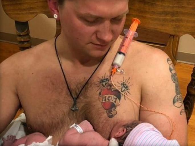 Breastfeeding by Father for Newborn! | जगातील पहिला पुरुष : नवजात कन्येला पित्याने दिले स्तनपान! Breastfeeding by Father for Newborn! | जगातील पहिला पुरुष : नवजात कन्येला पित्याने दिले स्तनपान!