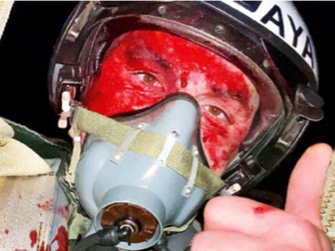 Let's fight till the last drop of blood!... Ukrainian with face covered in blood and still showing thumbs up | शेवटच्या थेंबापर्यंत लढत राहू !... चेहरा रक्ताने माखलेला आणि तरीही थंब्सअप दाखविणारा युक्रेनी