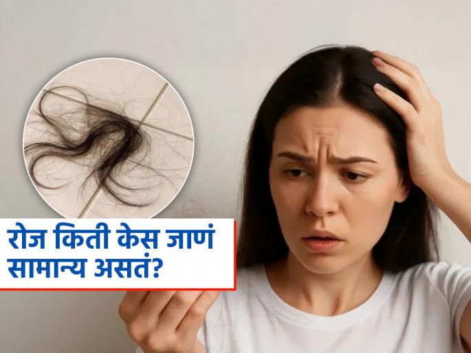 Hair Fall Tips : How much hair fall daily is considered normal | रोज किती केस गळणं-तुटणं असतं नॉर्मल? पाहा कधी चिंतेची बाब वाढते, काय कराल उपाय
