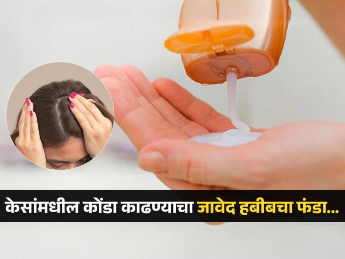 Javed Habib shares a simple solution to get rid of dandruff, you should try this | जावेद हबीबनं सांगितला केसांमधील कोंडा दूर करण्याचा सोपा उपाय, केस वाढतील आणि चमकदार होतील!