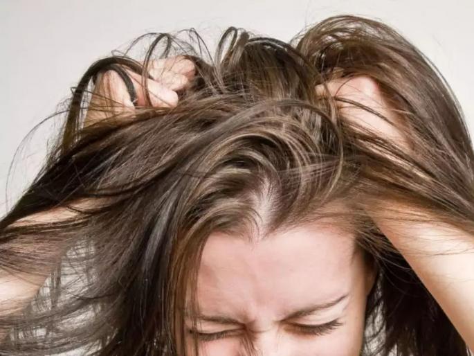 5 types of dandruff and how to get rid of them | ५ प्रकारचे असतात डॅंड्रफ आणि वेगवेगळे असतात त्यांचे उपाय, काय ते जाणून घ्या! 5 types of dandruff and how to get rid of them | ५ प्रकारचे असतात डॅंड्रफ आणि वेगवेगळे असतात त्यांचे उपाय, काय ते जाणून घ्या!