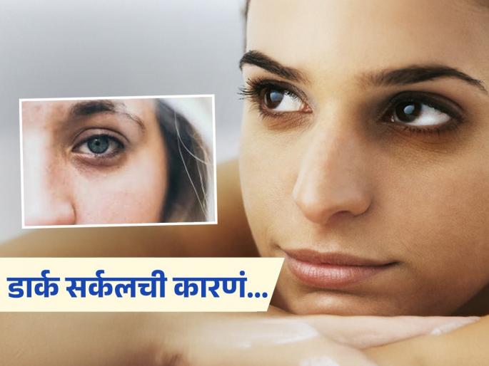 What is reason behind dark circles and how to reduce it | डार्क सर्कलमुळे हिरावलं जातं डोळ्यांचं आणि चेहऱ्याचं सौंदर्य, पण डार्क सर्कल येतात कशामुळे?