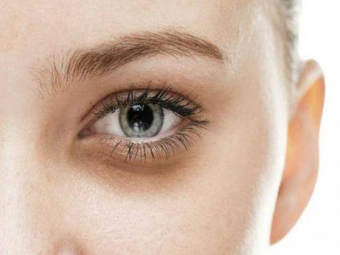 Dark circles causes and dark circle remedies | केवळ अपुरी झोप नाही तर 'ही' आहेत डोळ्याखाली काळे डाग येण्याची कारणे? Dark circles causes and dark circle remedies | केवळ अपुरी झोप नाही तर 'ही' आहेत डोळ्याखाली काळे डाग येण्याची कारणे?