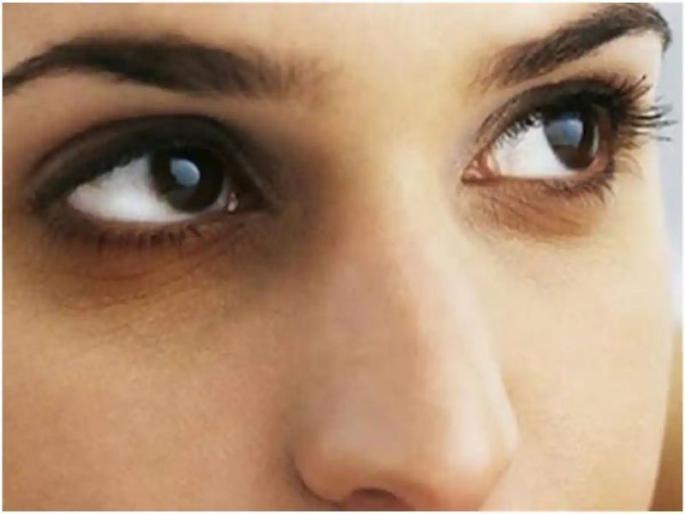 Even after using many products, it does not go to the dark circles under the eyes ... What could be the reason? | डोळ्याखालची काळी वर्तुळं आयुष्यात कधीतरी कमी होतील का?- या प्रश्नाचं हे घ्या उत्तर..