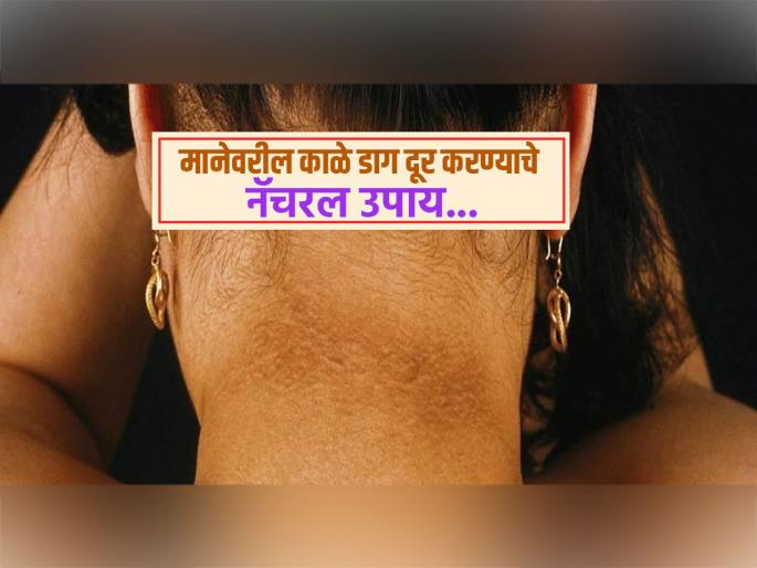 Home remedies for dark neck how to clean black neck | मानेवरील काळपटपणा कमीच होत नाहीये? लगेच करा 'हे' दोन घरगुती उपाय मग बघा कमाल...