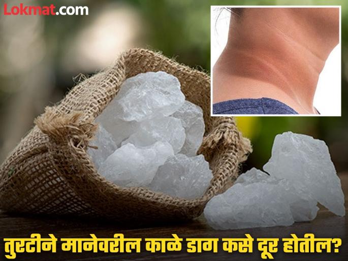 How to get rid of dark neck using alum | मानेवरील काळे डाग दूर करण्यासाठी तुरटीचा 'असा' करा वापर, काही दिवसात दिसेल फरक... How to get rid of dark neck using alum | मानेवरील काळे डाग दूर करण्यासाठी तुरटीचा 'असा' करा वापर, काही दिवसात दिसेल फरक...