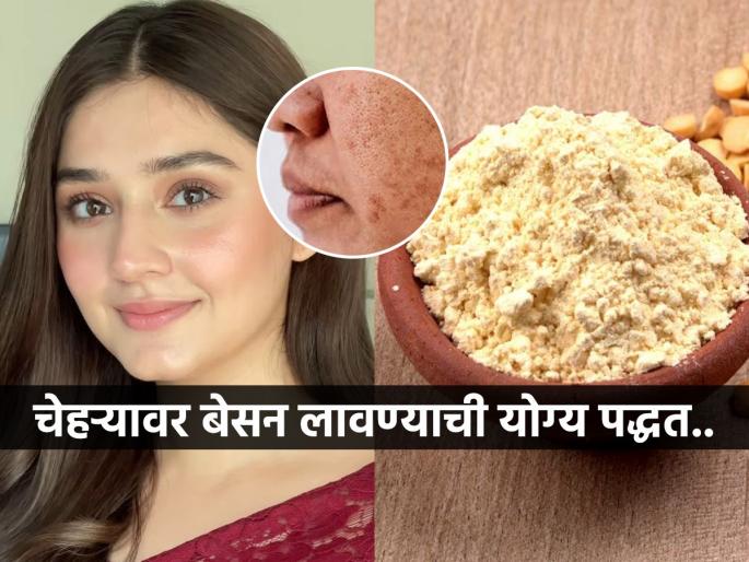 Mix these things with besan to remove black spots from face | चेहऱ्यावर काळे डाग? बेसनाचा 'असा' करा वापर, चेहरा दिसेल सतेज आणि डागही जातील कायमचे