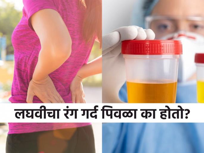 What is the sign of dark yellow urine in the morning, know causes | सकाळी गर्द पिवळ्या रंगाची लघवी येणं नॉर्मल की गंभीर? पाहा काय असू शकतात याची कारणं...