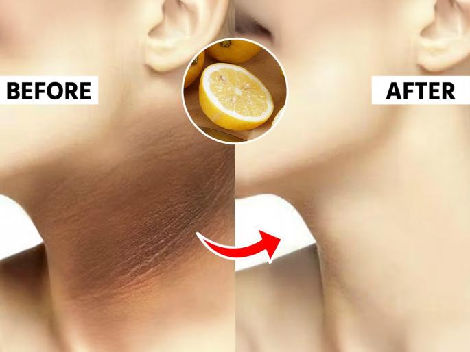 how to remove dark neck and elbows naturally at home with lemon quick home remedy for dark skin on neck and elbows in 15 minutes | कोपर- मान काळी पडली? काळवंडलेली त्वचा उजळण्यासाठी लिंबाचा 'असा' करा वापर, १५ मिनिटांत दिसेल फरक